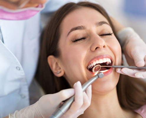 čiščenje zobnega kamna